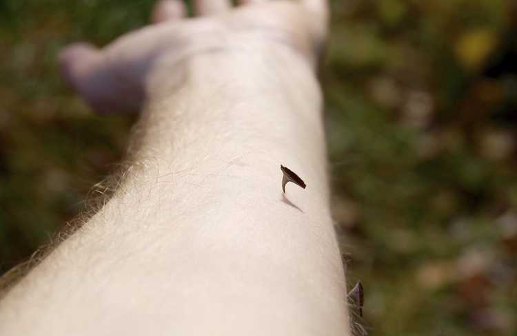 You are currently viewing Qu'est-ce que la maladie du cueilleur de roses : conseils pour prévenir une infection à l'épine de rose